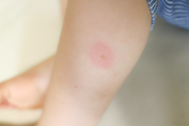 医師の診察を受ける時期