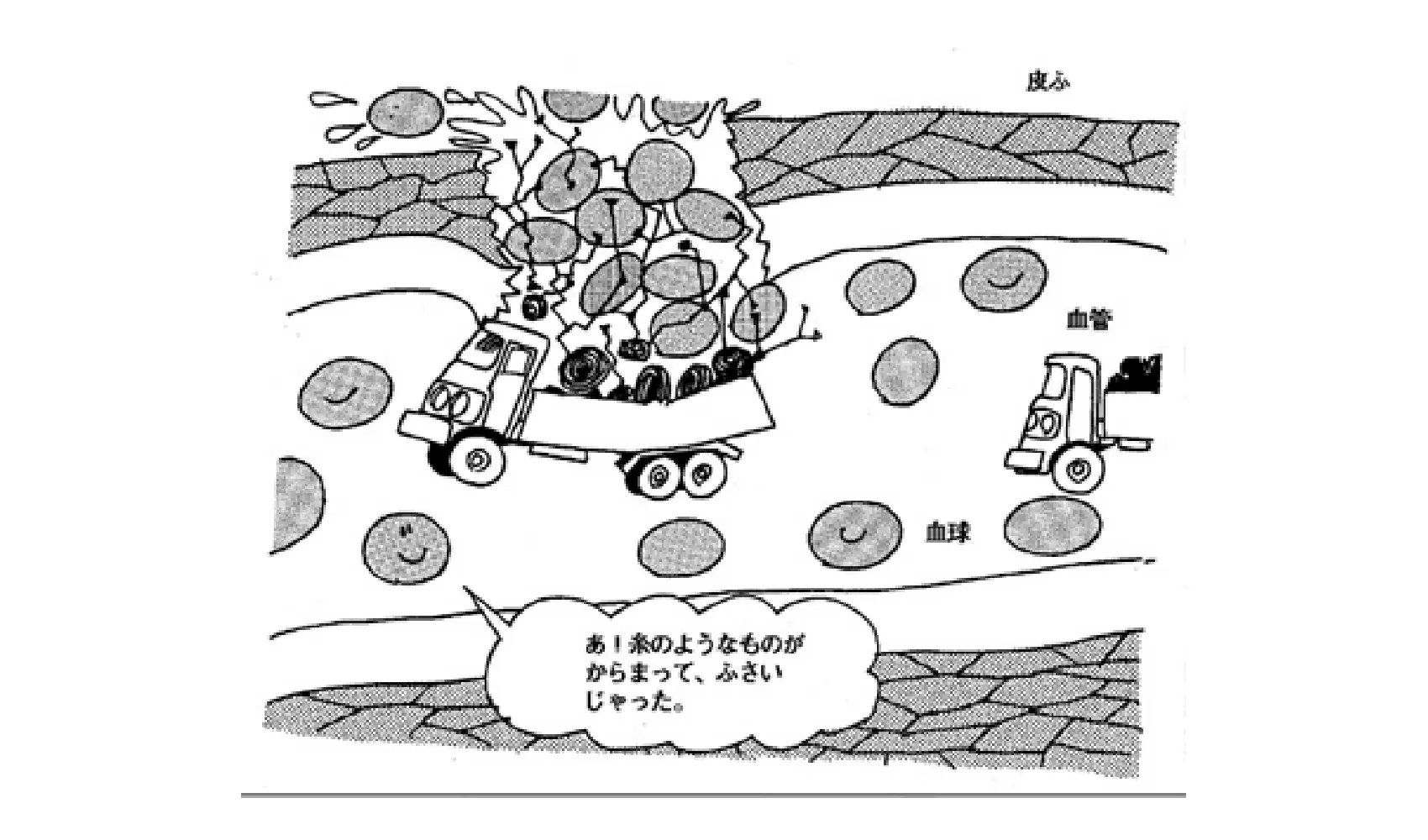 どうして血はひとりでに止まるの