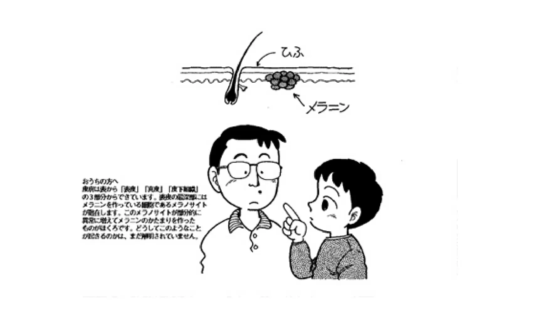 どうしてほくろはできるの