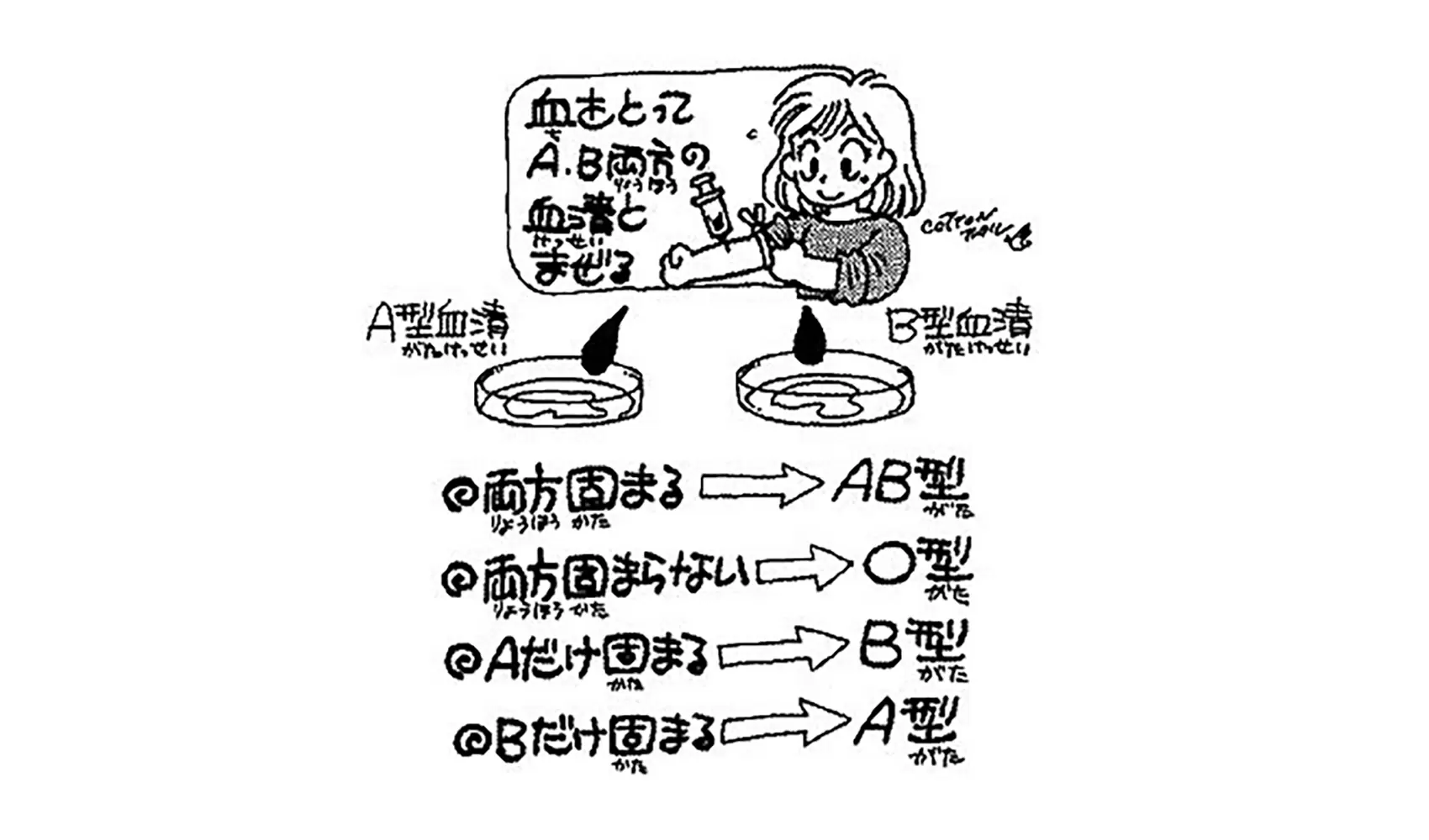 どうやってＡ、Ｂ、Ｏ、ＡＢの血液型を決めるの | ヒト | 科学なぜなぜ110番 | 科学 | 学研キッズネット