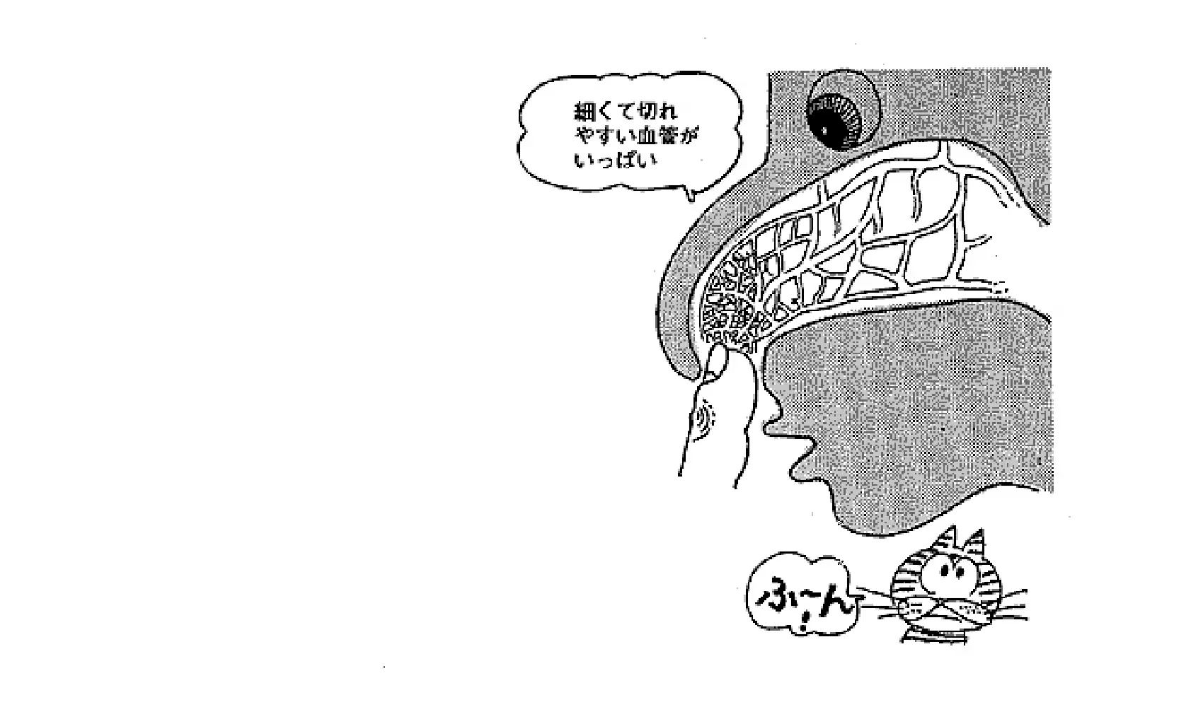 なぜ鼻血がでるの