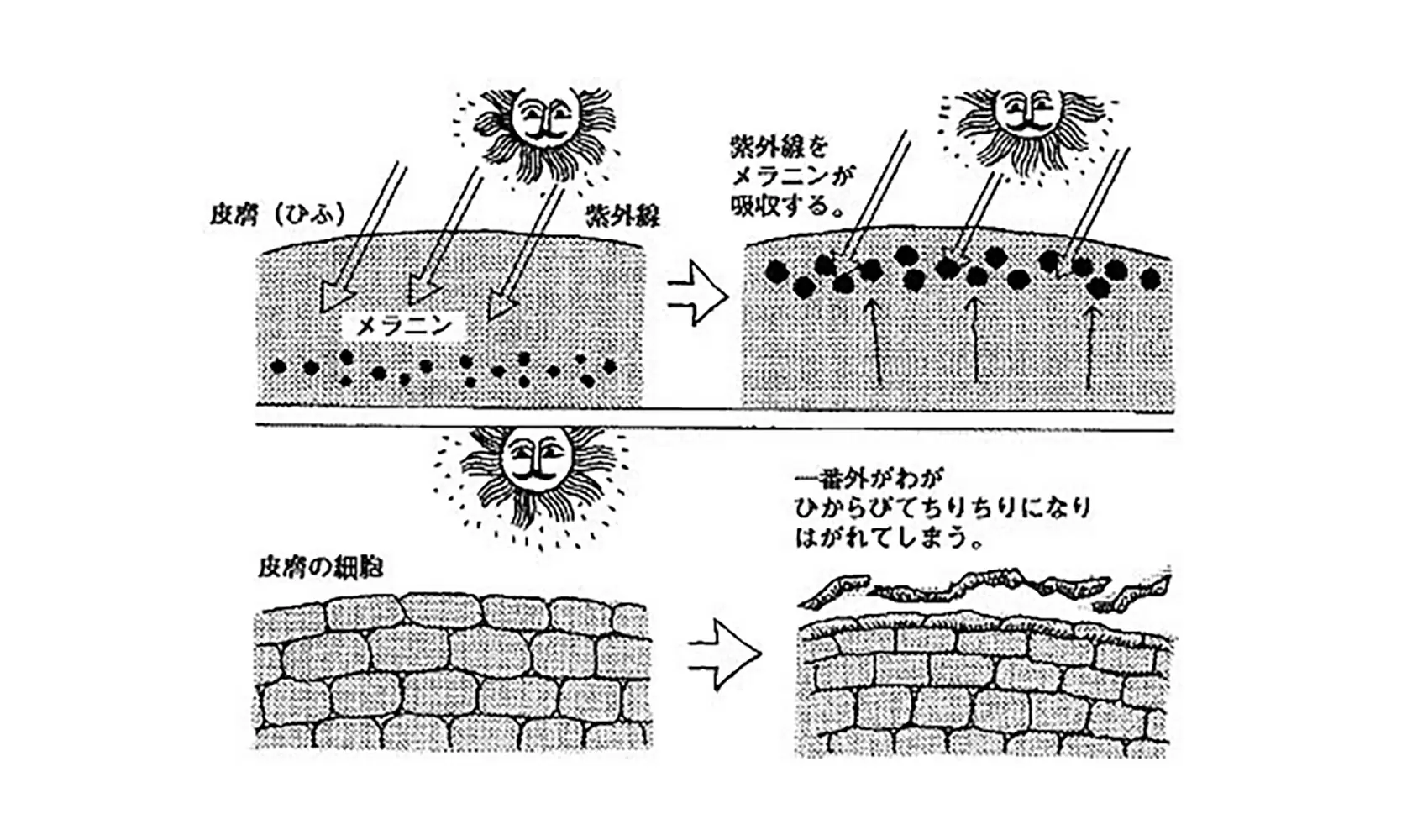 どうして日焼けするの、日焼けすると皮がむけるの