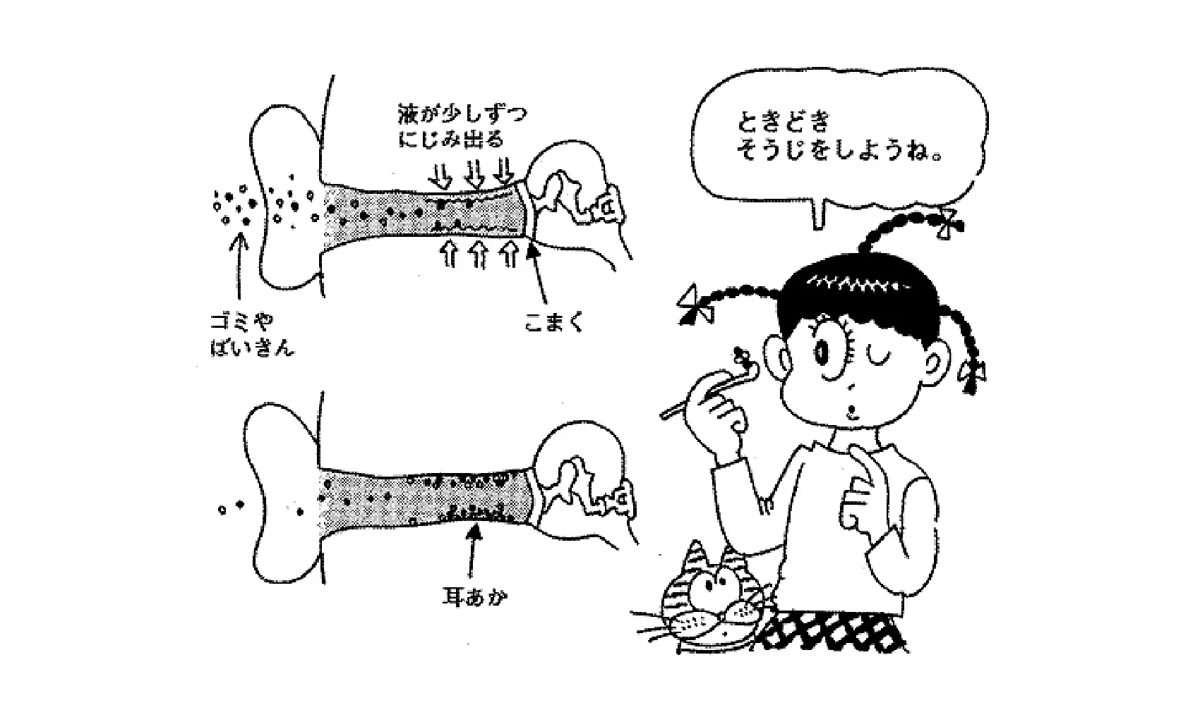 どうして耳あかがでるの