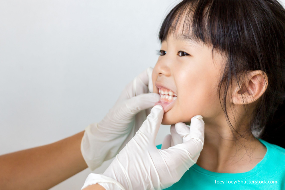むし歯は“予防”から“予測”へ。子どもの歯を守る歯医者の通い方【専門医が解説】